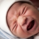 Babies’ Colic Linked to Mothers’ Migraines