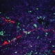 Bacteria Trigger Nerve Cells to Cause Pain